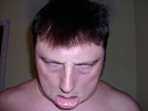 todd KY, United States