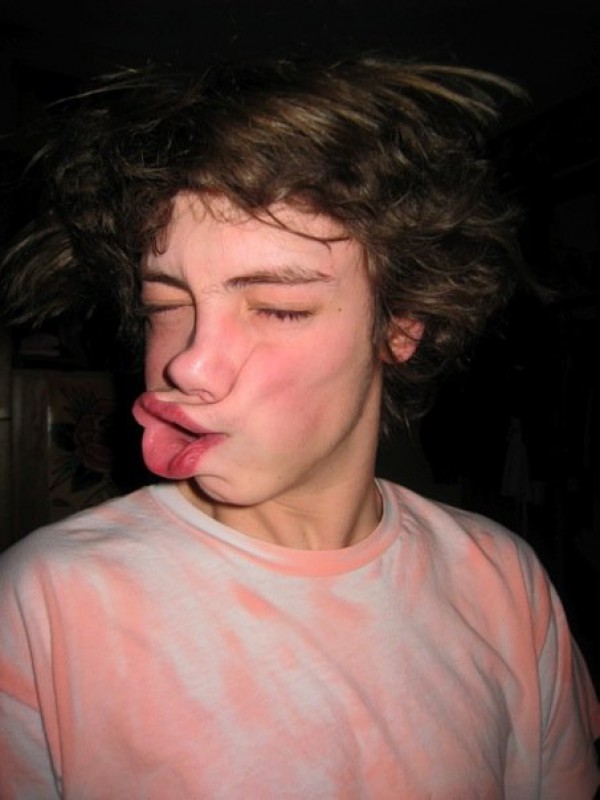 Andrew Eichhorn MD, United States